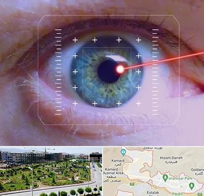 فمتولیزیک در پردیس