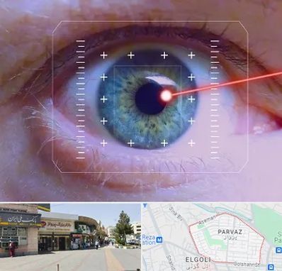 فمتولیزیک در پرواز تبریز