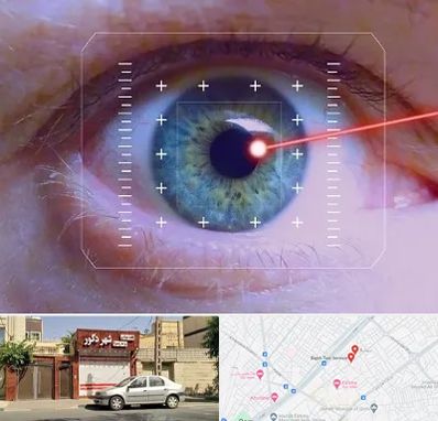 فمتولیزیک در باجک قم