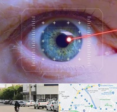 فمتولیزیک در قدوسی شرقی شیراز