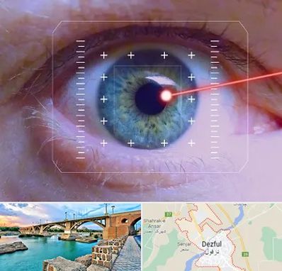 فمتولیزیک در دزفول