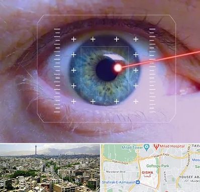 فمتولیزیک در گیشا 