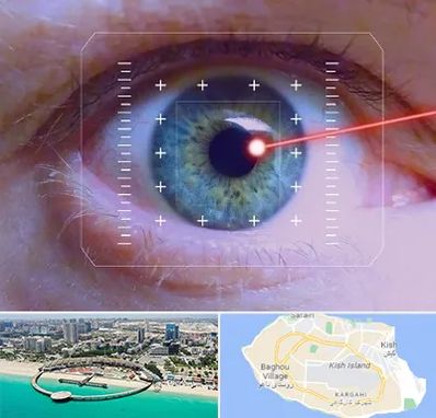 فمتولیزیک در کیش