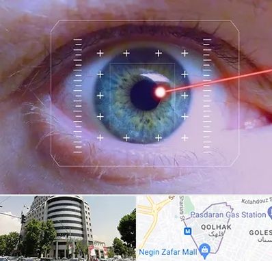 فمتولیزیک در قلهک 