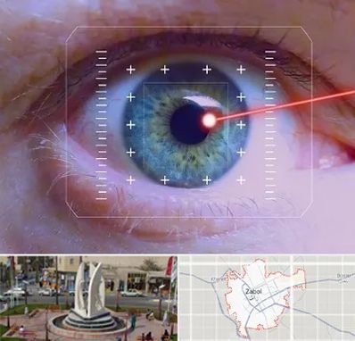 فمتولیزیک در زابل