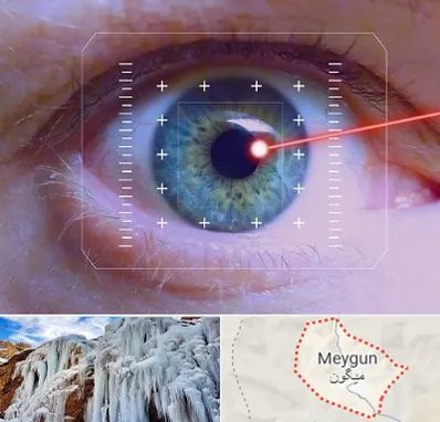 فمتولیزیک در میگون