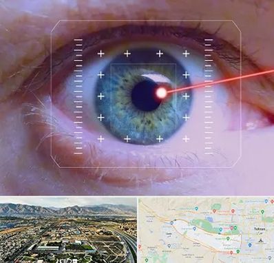 فمتولیزیک در منطقه 21 تهران 