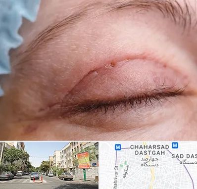 جراح پلک در چهارصد دستگاه 