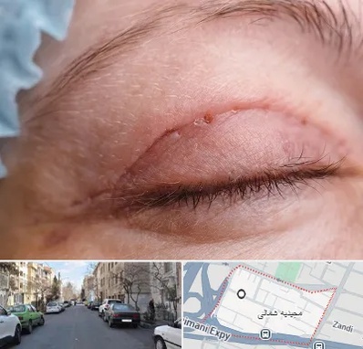 جراح پلک در مجیدیه شمالی