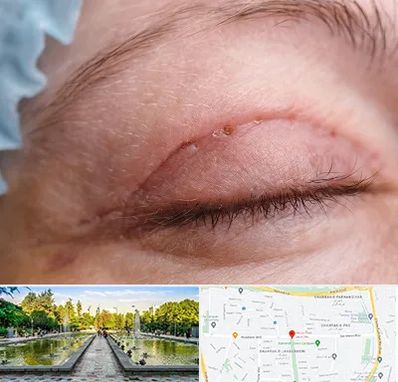 جراح پلک در سرسبز 