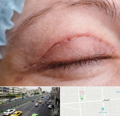 جراح پلک در خیابان دامپزشکی
