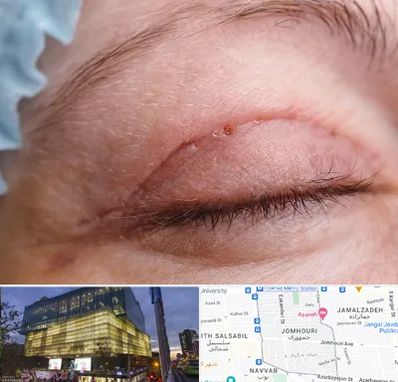 جراح پلک در جمهوری 