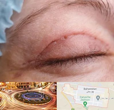 جراح پلک در بهارستان