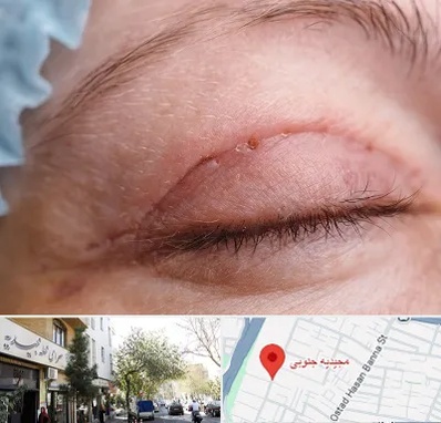 جراح پلک در مجیدیه جنوبی