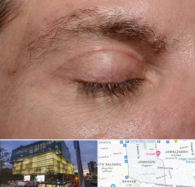 جراح بلفاروپلاستی در جمهوری 