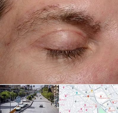 جراح بلفاروپلاستی در خیابان زند شیراز