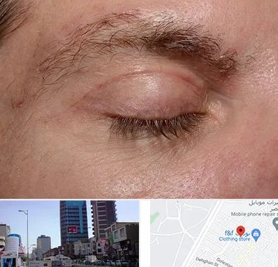 جراح بلفاروپلاستی در چهارراه طالقانی کرج