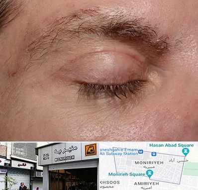 جراح بلفاروپلاستی در منیریه 