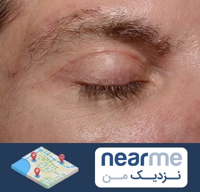 جراح بلفاروپلاستی در نزدیک من
