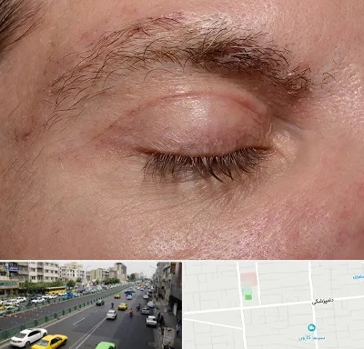 جراح بلفاروپلاستی در خیابان دامپزشکی