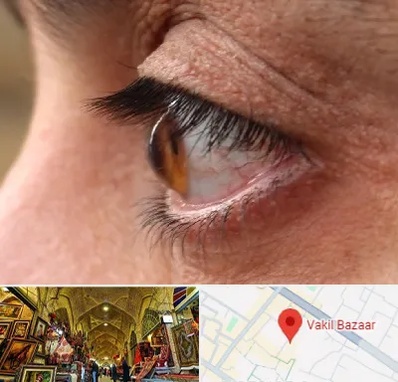 متخصص قوز قرنیه در بازار وکیل شیراز