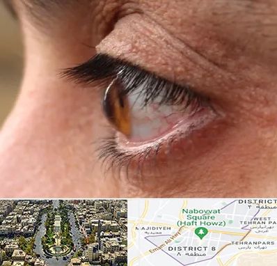 متخصص قوز قرنیه در نارمک 