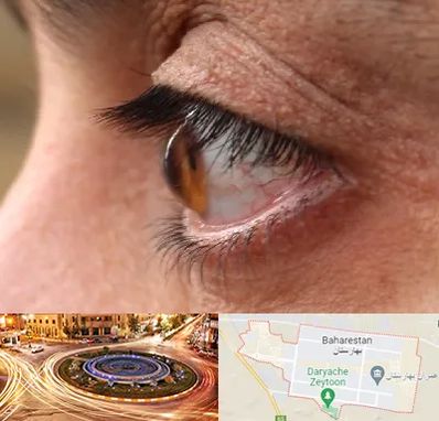 متخصص قوز قرنیه در بهارستان