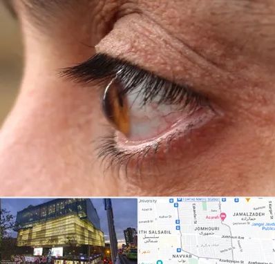 متخصص قوز قرنیه در جمهوری 