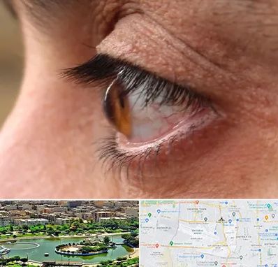 متخصص قوز قرنیه در منطقه 9 تهران 