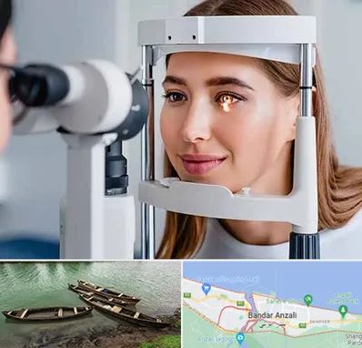 دکتر چشم پزشک خوب در بندر انزلی