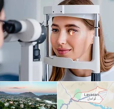 دکتر چشم پزشک خوب در لواسان