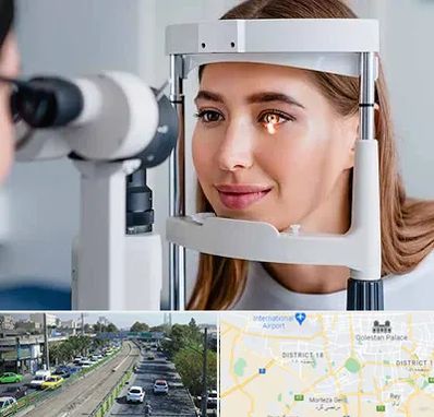 دکتر چشم پزشک خوب در جنوب تهران 