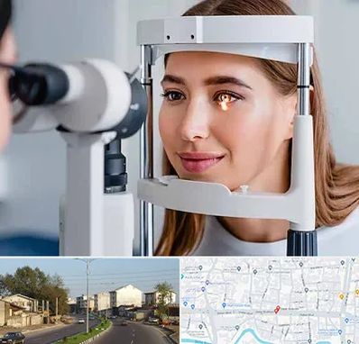 دکتر چشم پزشک خوب در ضیابری رشت