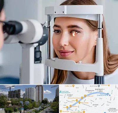 دکتر چشم پزشک خوب در اندرزگو