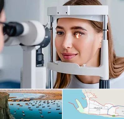 دکتر چشم پزشک خوب در چابهار