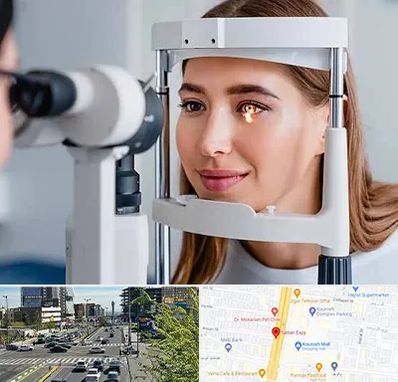 دکتر چشم پزشک خوب در ستاری 