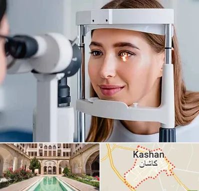 دکتر چشم پزشک خوب در کاشان