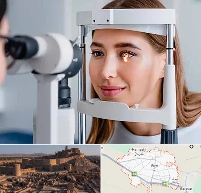 دکتر چشم پزشک خوب در بم