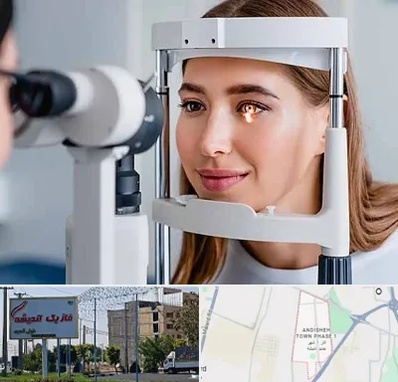 دکتر چشم پزشک خوب در فاز یک اندیشه