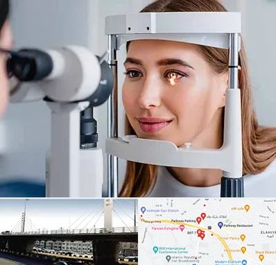 دکتر چشم پزشک خوب در پارک وی 