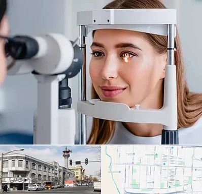 دکتر چشم پزشک خوب در 17شهریور