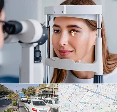 دکتر چشم پزشک خوب در مفتح مشهد