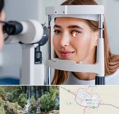 دکتر چشم پزشک خوب در شیروان