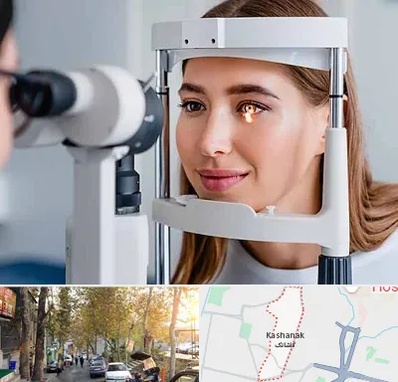 دکتر چشم پزشک خوب در کاشانک