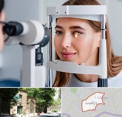 دکتر چشم پزشک خوب در دزاشیب