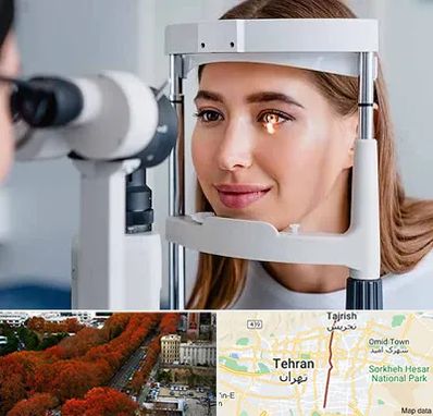 دکتر چشم پزشک خوب در ولیعصر 