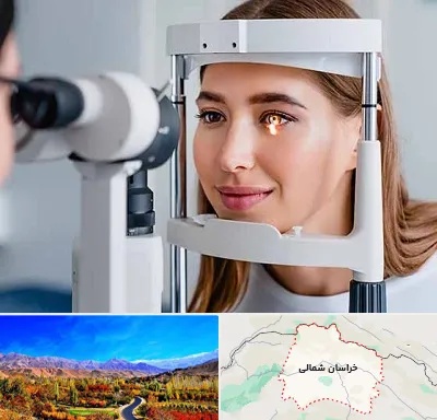 دکتر چشم پزشک خوب در خراسان شمالی