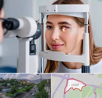 دکتر چشم پزشک خوب در لویزان