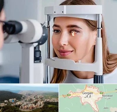 دکتر چشم پزشک خوب در گرگان