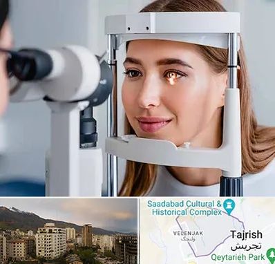 دکتر چشم پزشک خوب در زعفرانیه 